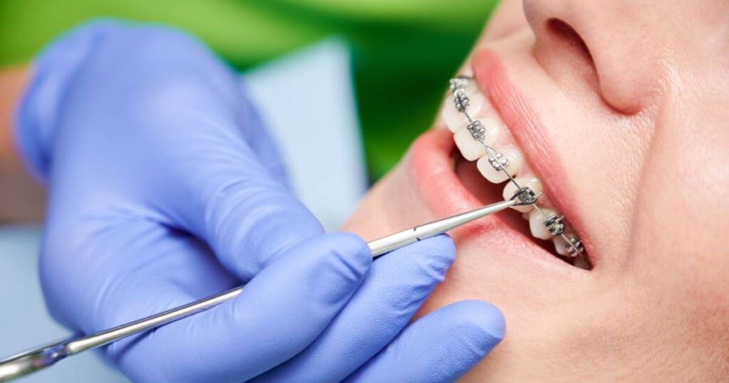 The Art and Science of Orthodontists Designing Smiles