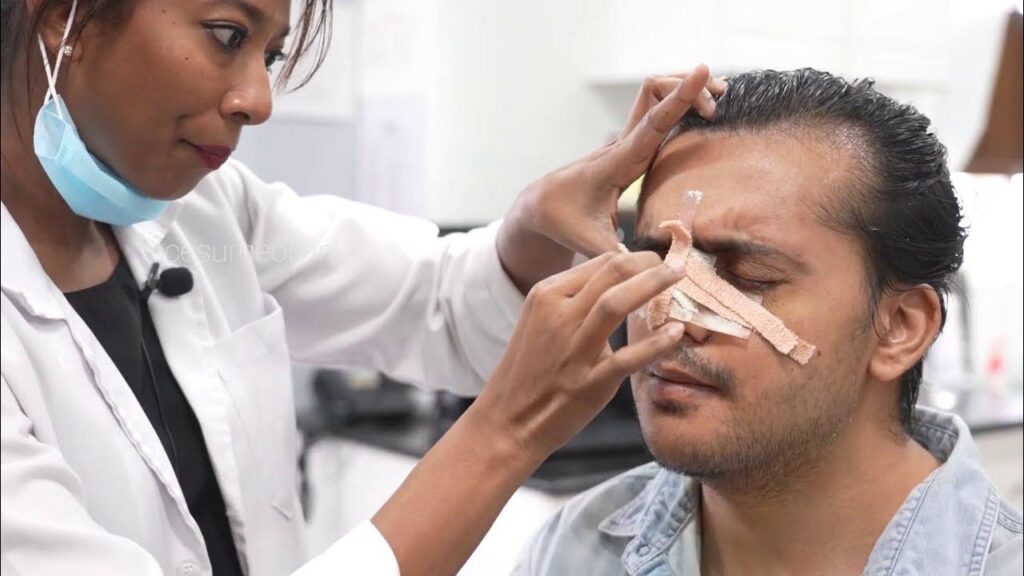 Transform Your Profile with Rhinoplasty