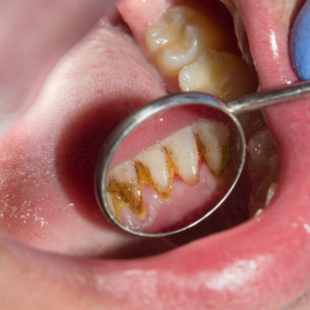 Oral and maxillofacial surgery consultation in Dubai
