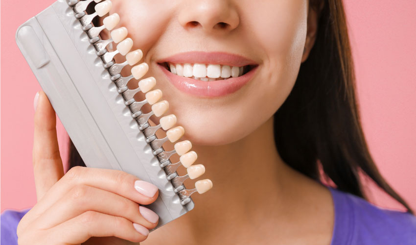 What to Expect Before and After Getting Dental Veneers