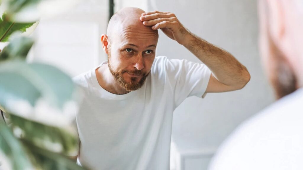 Finasteride 1mg for hair loss