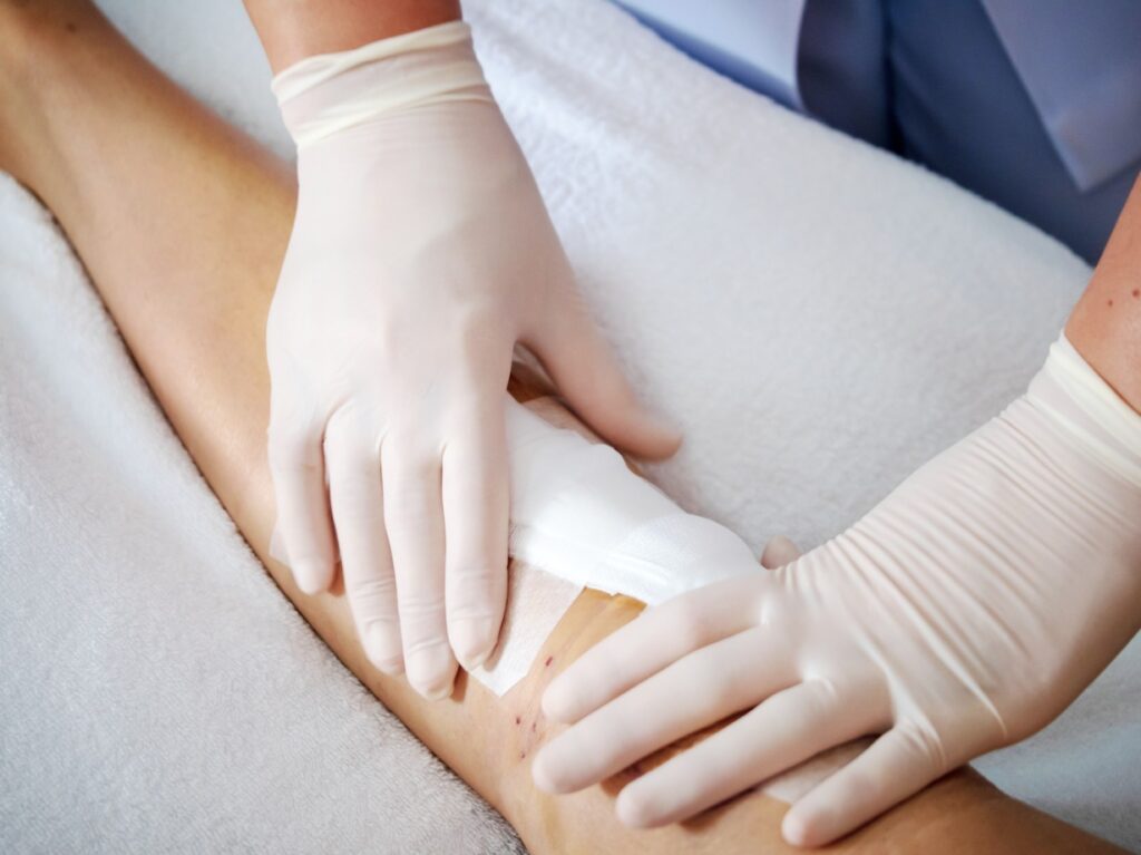 Wound Dressing at home
