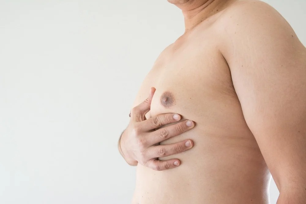 Gynecomastia Treatment