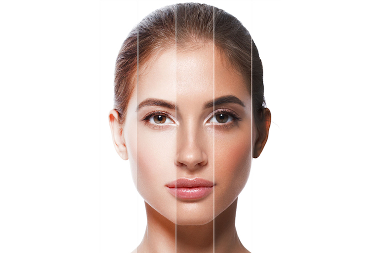 Cold Peel