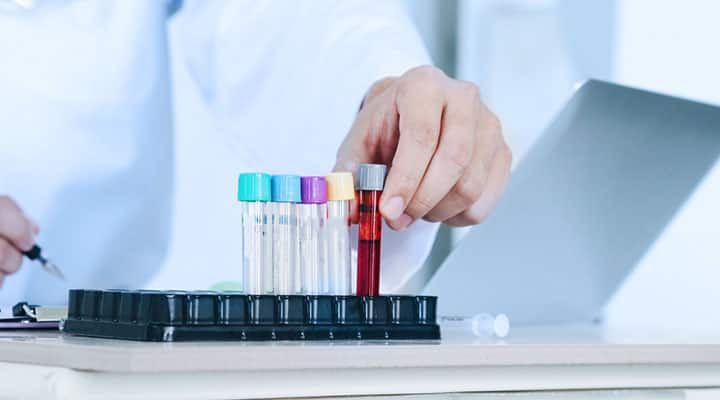What Precautions Are Needed for Blood Test at Home?
