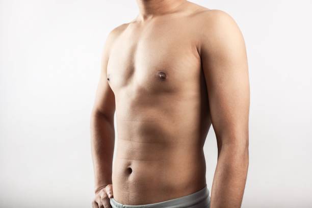 Gynecomastia Male Breast Reduction