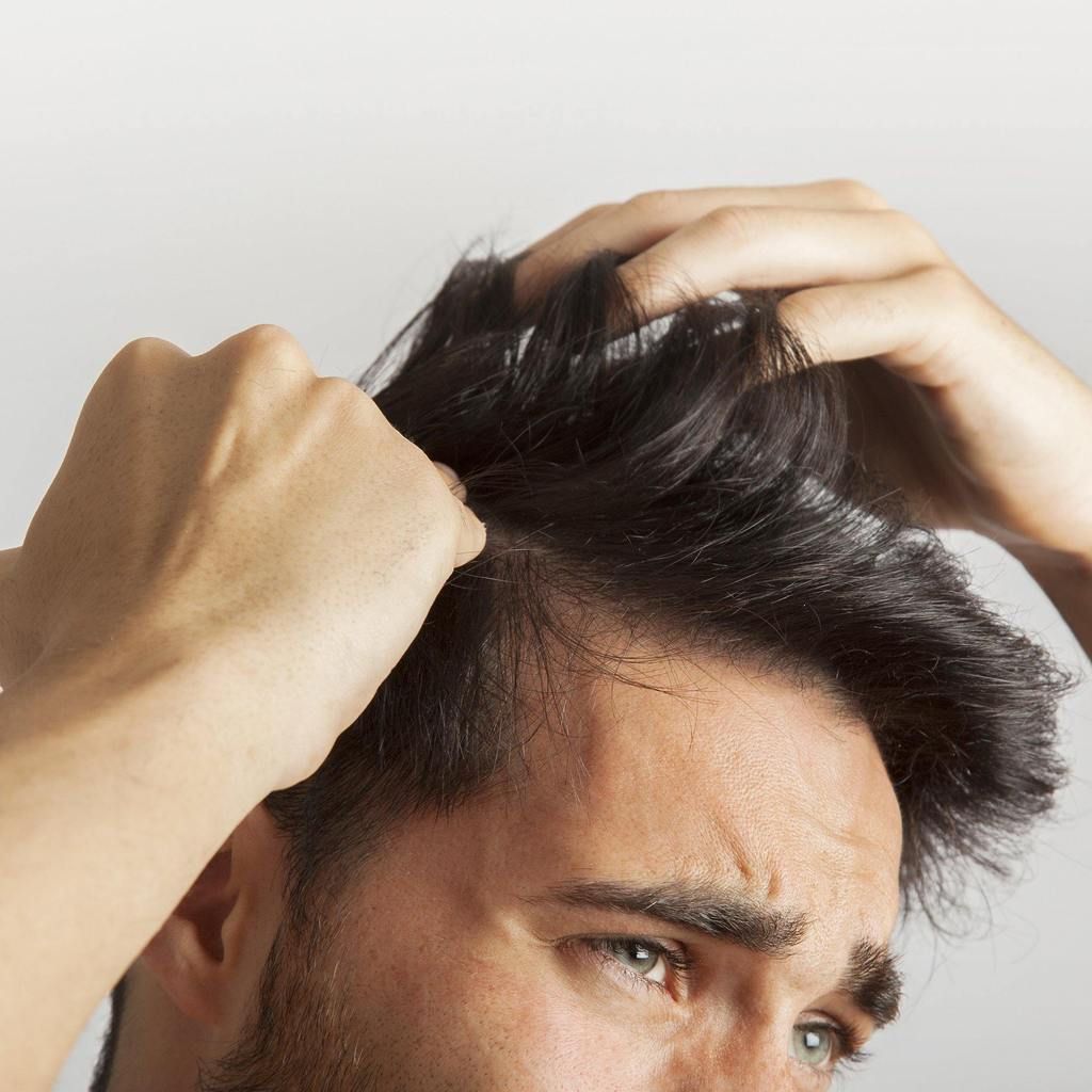 Hair Transplant in Riyadh