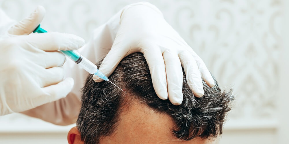 Best PRP Hair Treatment