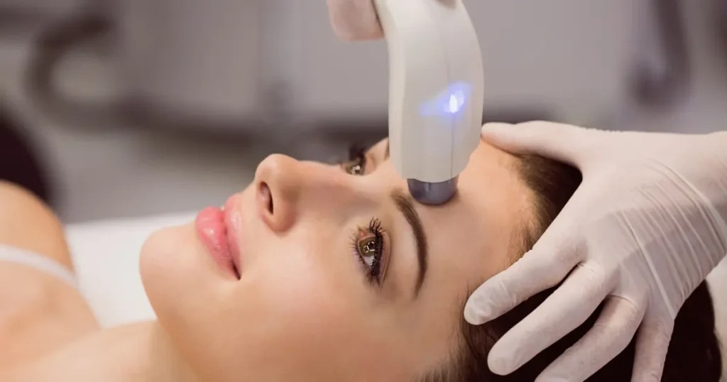 Laser Skincare Treatments