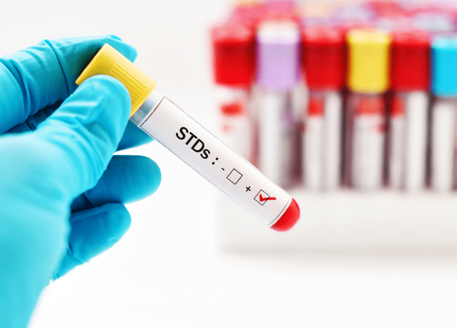 Can STD Tests Detect Past Infections?