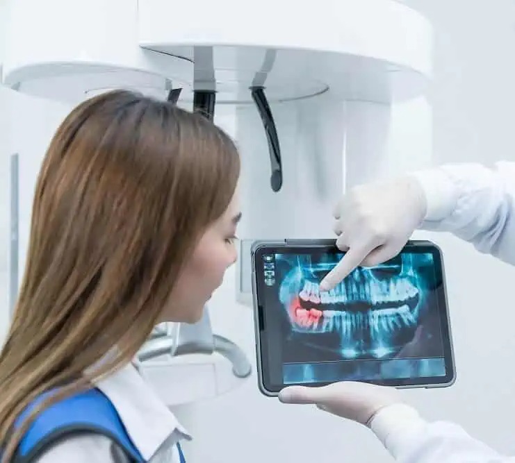 Panoramic Dental X-Ray
