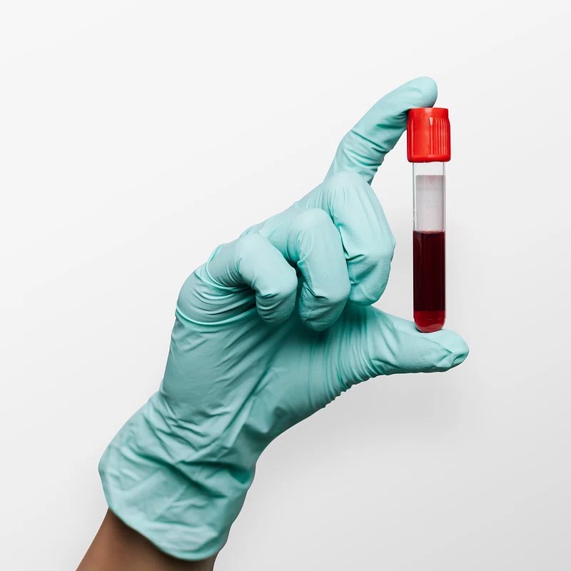 Blood Test at home