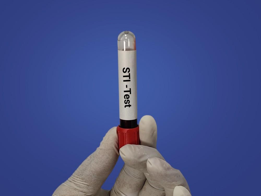 Why STD Tests Should Not Be Ignored