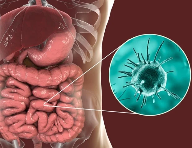Amoebiasis