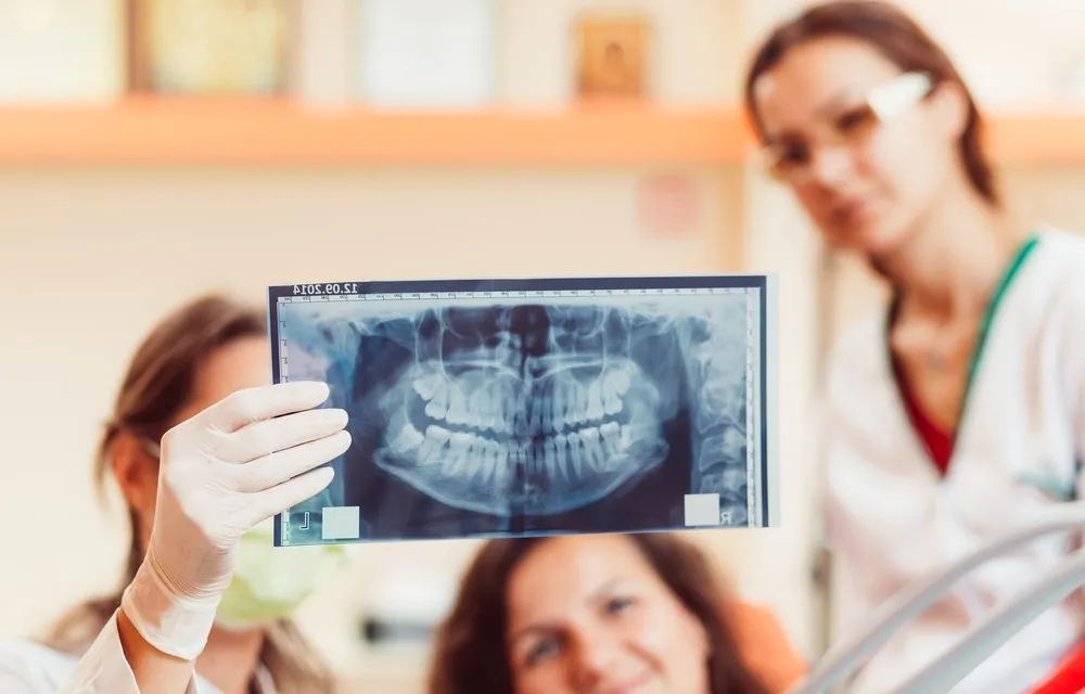 Panoramic Dental X-Ray Cost for Orthodontic Assessments