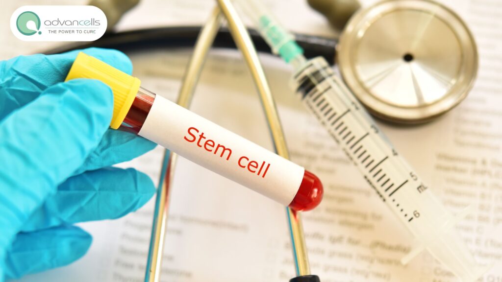 Stem-Cell-Therapy