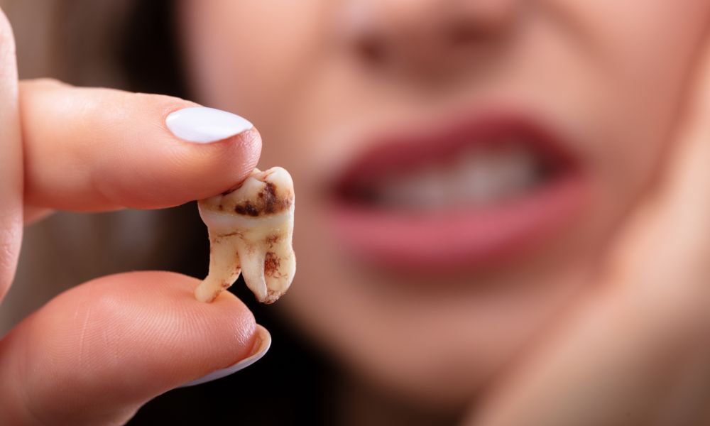 Tooth Extraction Cost for Pediatric Patients