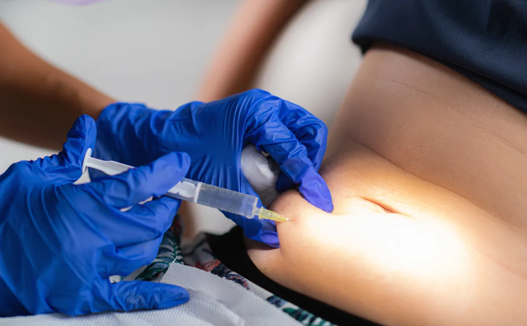 What Should You Know Before Weight Loss Injections