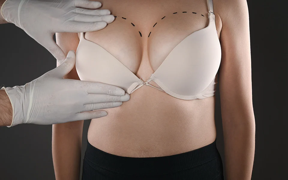 Breast Lift