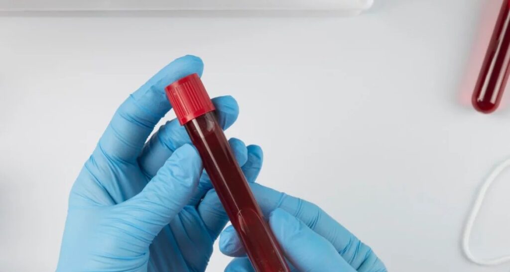 Blood Test at Home in Dubai