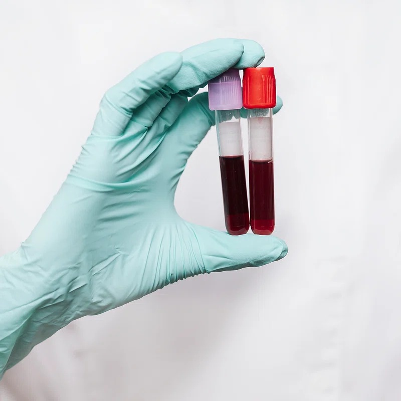 Blood Test at Home