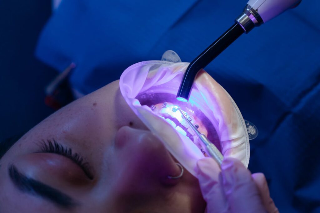 Night Guards for Teeth