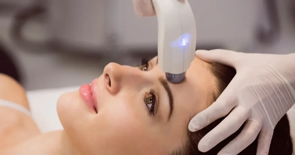 Discover the Most Effective Melasma Treatments