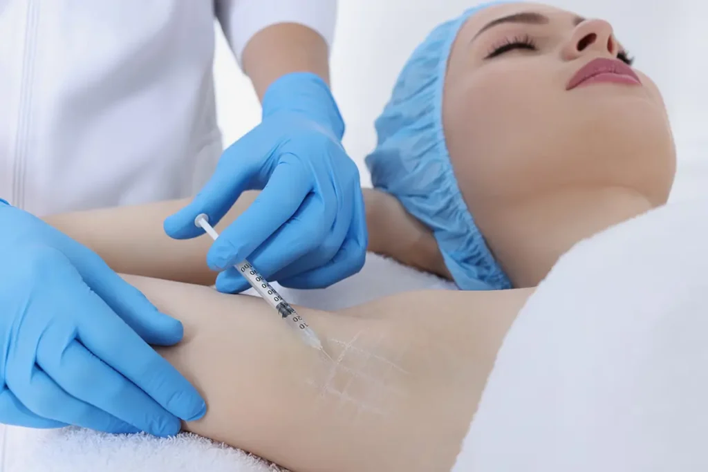 Effective Sweat Management with Botox