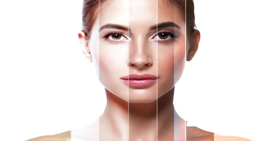 Laser Skincare Treatments for Darker Skin Tones