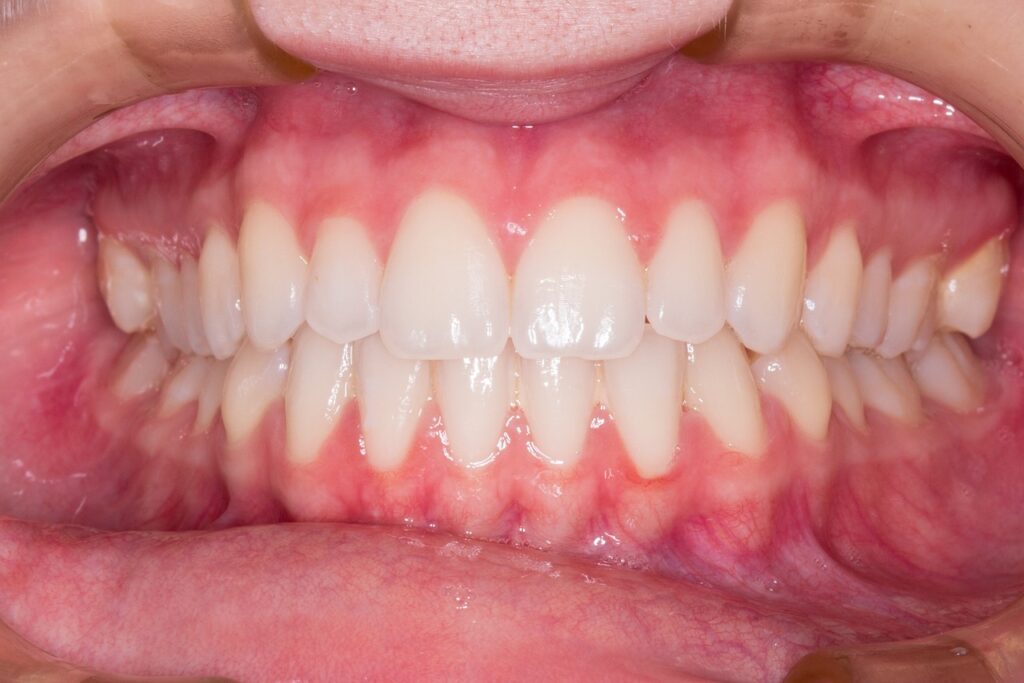 Cosmetic Dentistry in Beaverton OR