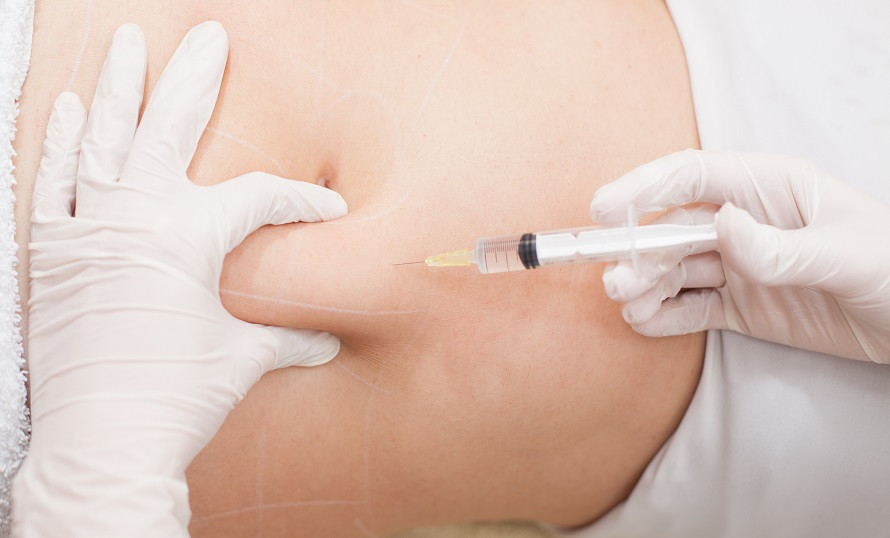 Affordable Fat Melting Injection Options