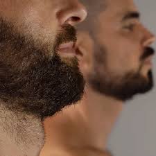Fuller beard with permanent results