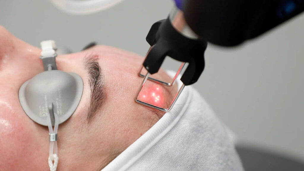 How Pico Laser Treatment Supports Clearer Skin