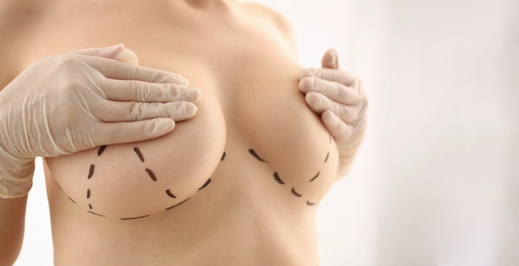 How To Prepare For Breast Augmentation Surgery
