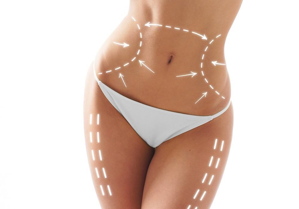 Is Body Contouring Treatment Better Than Surgery