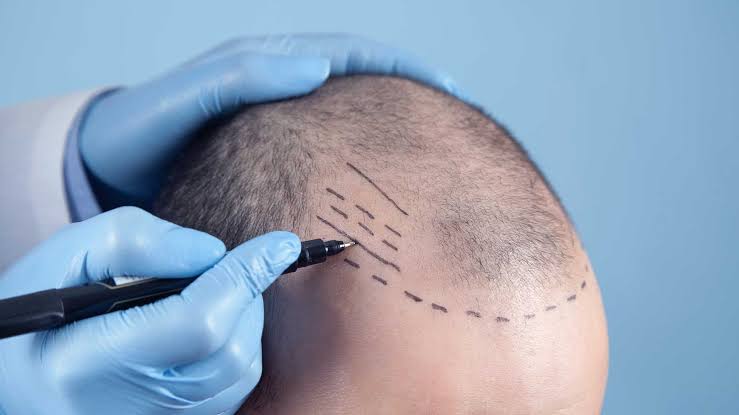 Is GFC Treatment for Hair Painful or Comfortable