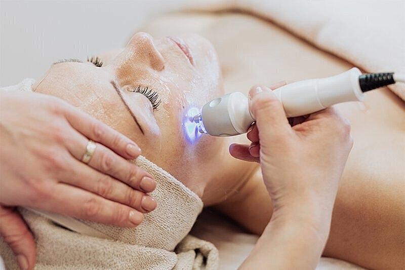 Is Melasma Treatment safe for sensitive skin