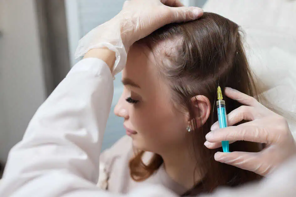 Best PRP Hair Treatment for Sensitive Scalp