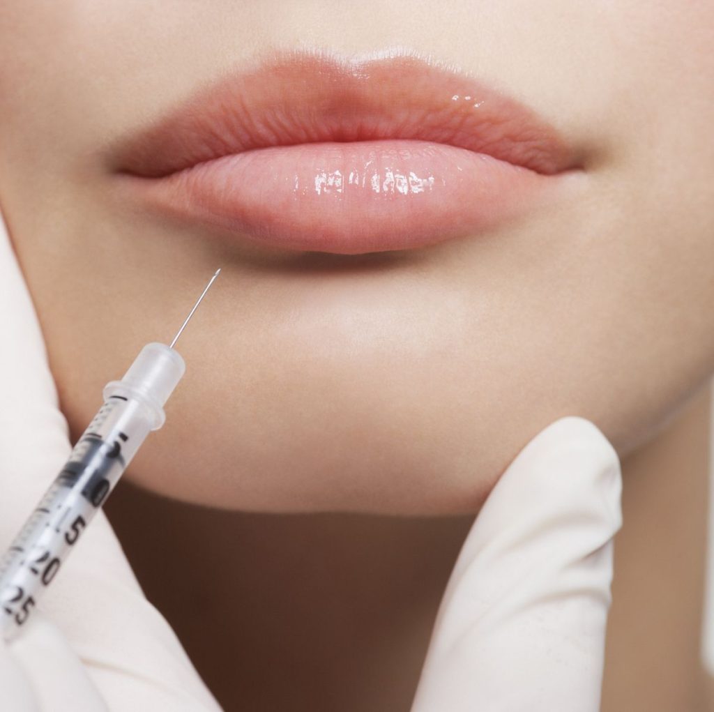 What Are Common Misconceptions About Lip Filler?