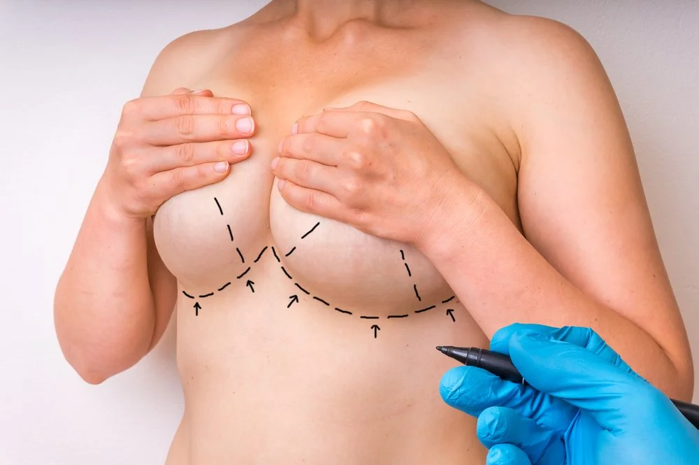 Is Breast Lift Surgery Safe for Older Women With Sagging