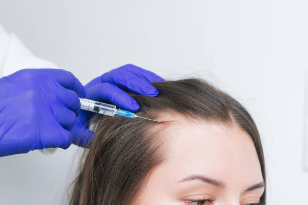 Is Hair Fillers Treatment Suitable for Men and Women