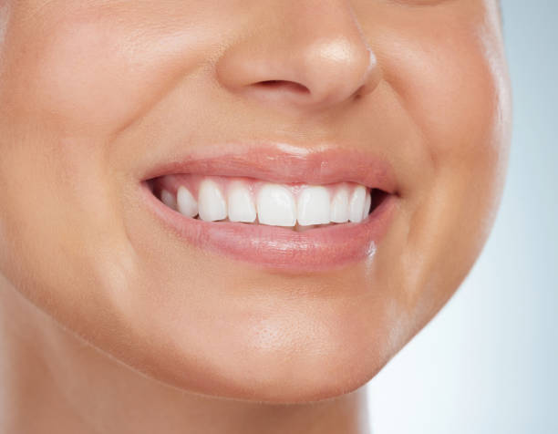 What Are the Fastest Teeth Whitening Methods That Work