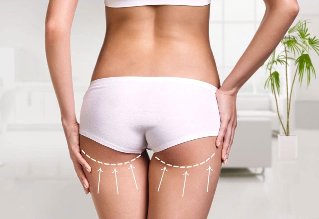 What Is the Best Age for Buttock Augmentation Surgery
