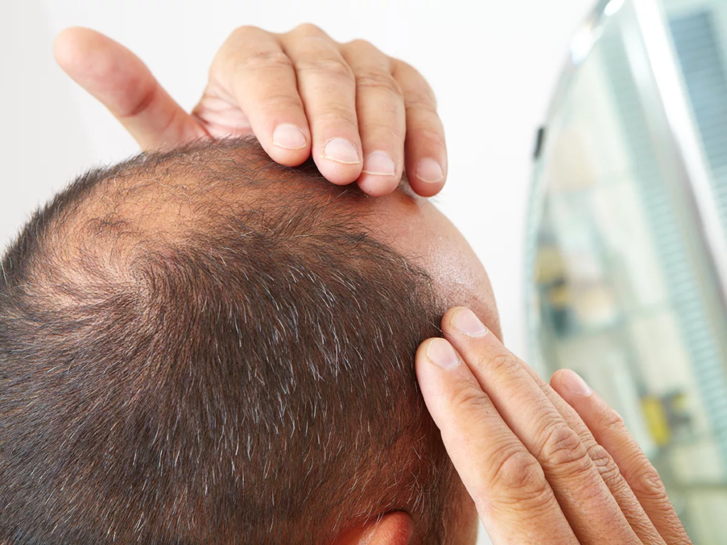 What Makes GFC Treatment for Hair So Popular