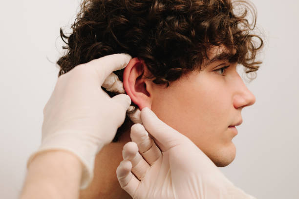What Recovery Time Is Needed After Ear Reshaping