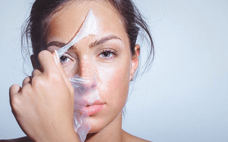 What Skin Types Benefit Most From Chemical Peels
