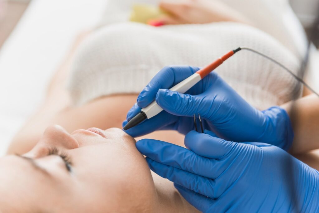 What areas respond best to electrolysis treatment