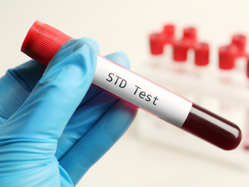 STD Test and Preventing Complications