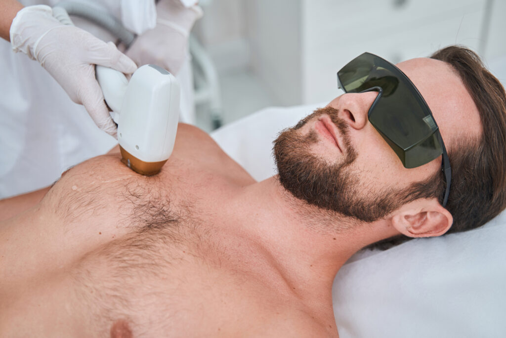 Does Men’s Laser Hair Removal Hurt Much