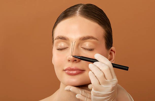 Does Rhinoplasty Help with Nose Size Reduction